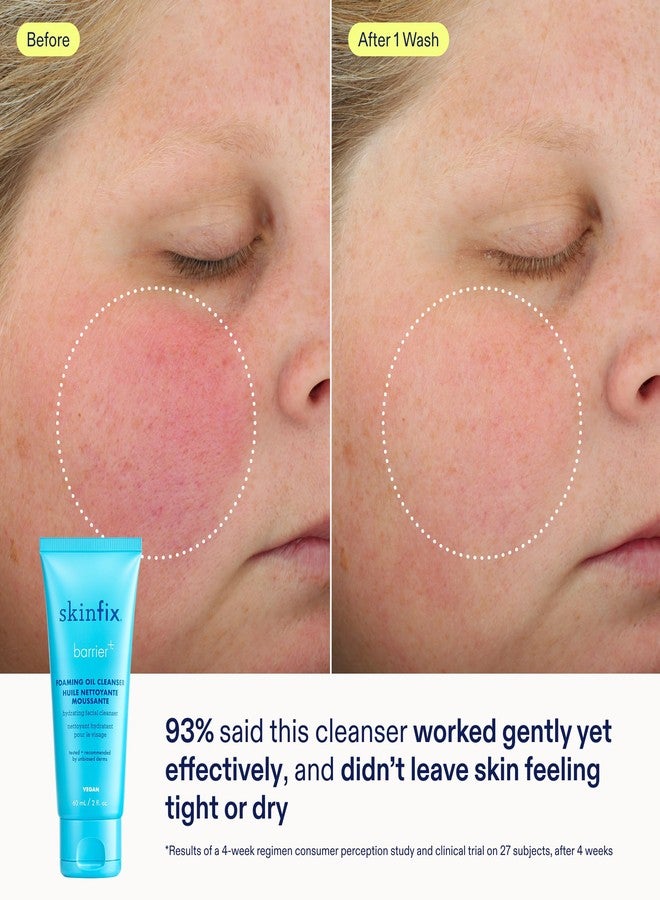 Skinfix Barrier+ Better Skin Starts Here Kit - Includes Mini Triple Lipid-Peptide Cream (0.5 oz), Mini Foaming Oil Cleanser (2 oz) & Mini Triple Lipid Activating Serum (0.35 oz) - Vegan, Cruelty Free - Image 3